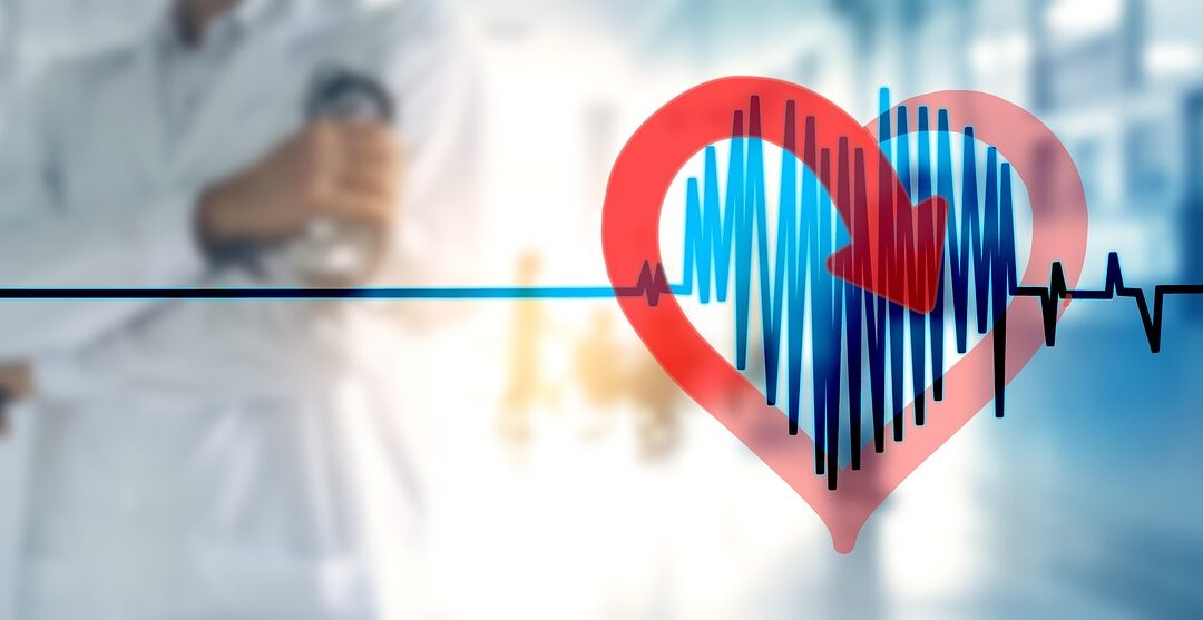 Atrial Fibrillation (AFib): Complete Guide to Symptoms, Stroke Risk, Treatment, and Prevention